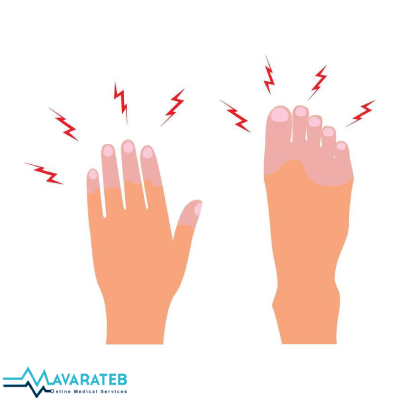 علت احساس گزگز بدن