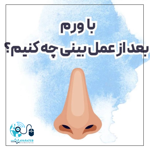 با ورم بعد از عمل بینی چه کنیم؟