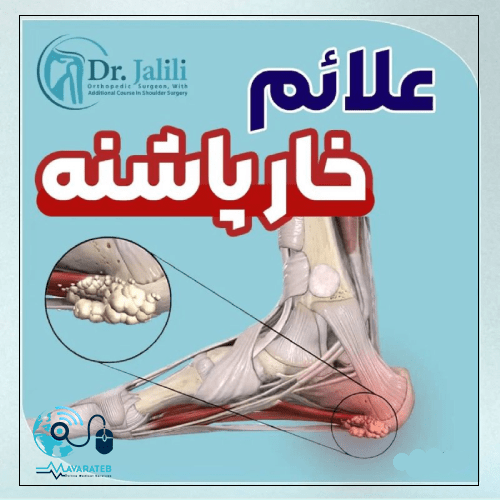 علائم خار پاشنه