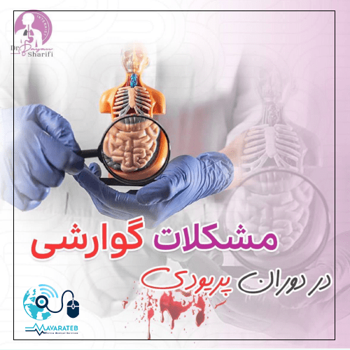مشکلات گوارشی در دوران پریودی