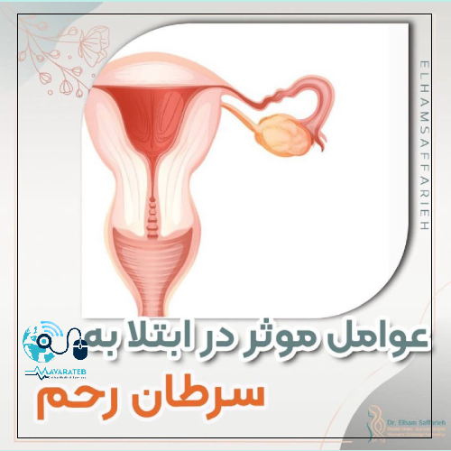 عوامل موثر در ابتلا به سرطان رحم