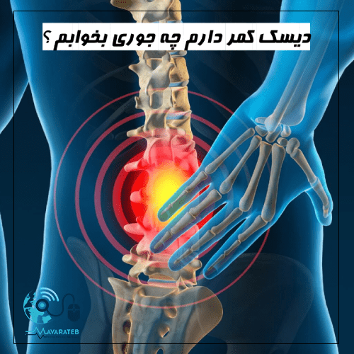 دیسک کمر دارم چه جوری بخوابم؟