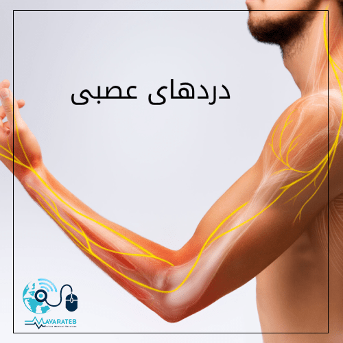 دردهای عصبی