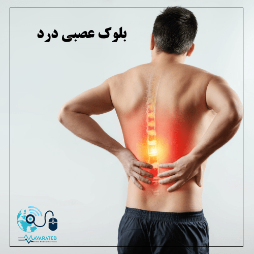بلوک عصبی درد در ناحیه کمر