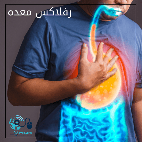 رفلاکس معده چیست؟