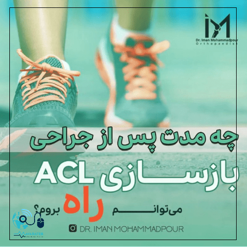 مدت زمان راه رفتن بعد از عمل ACL