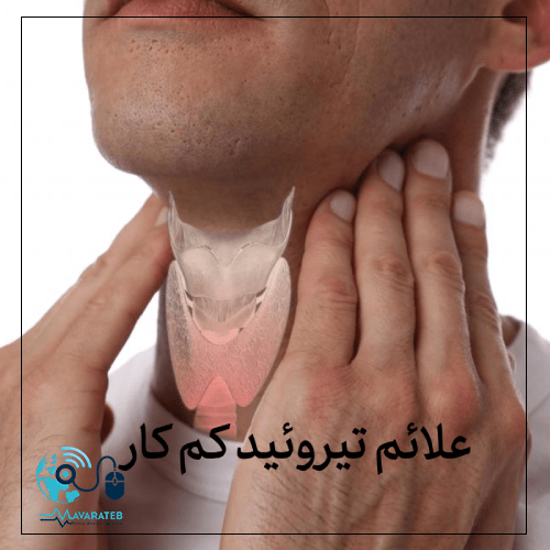 تیروئید کم کار