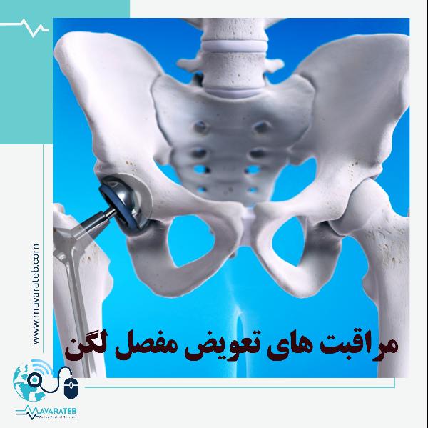 دوره نقاهت تعویض مفصل لگن