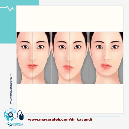 جراحی انحراف فک