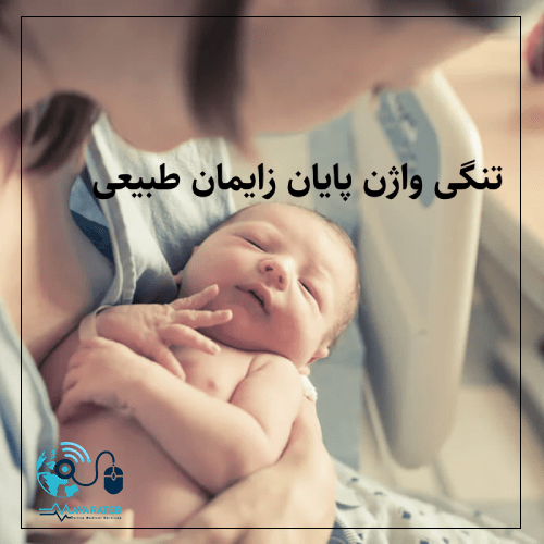 تنگی واژن پایان زایمان طبیعی