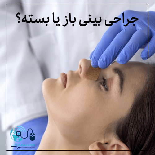 جراحی بینی باز یا بسته؟