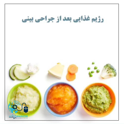 از مصرف این غذاها بعد از عمل بینی بپرهیزید