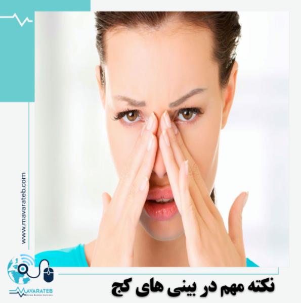 نکته مهم در کج شدن بینی