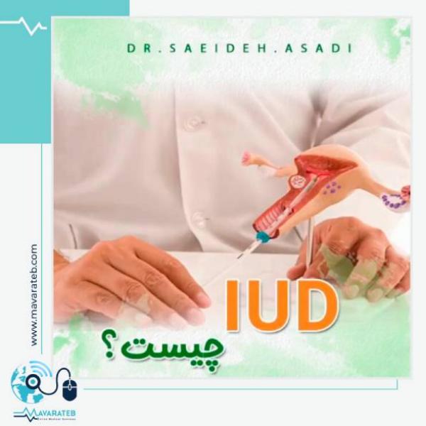 IUD چیست؟