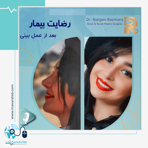 عمل بینی گوشتی در مشهد