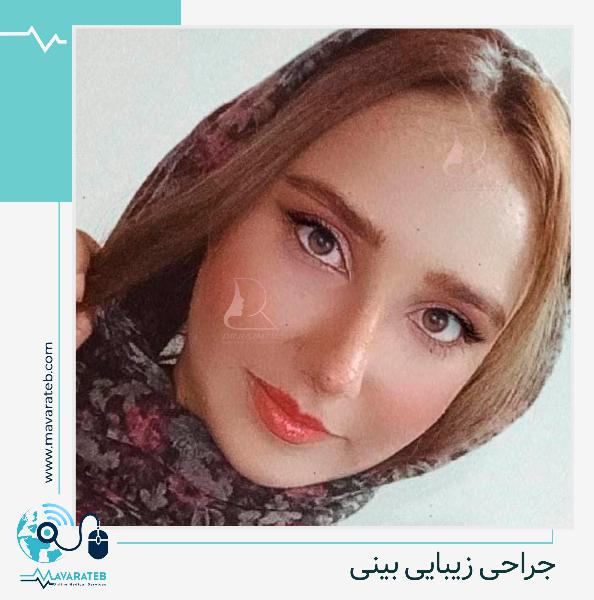 نمونه عمل بینی زیباجو عزیز در مشهد