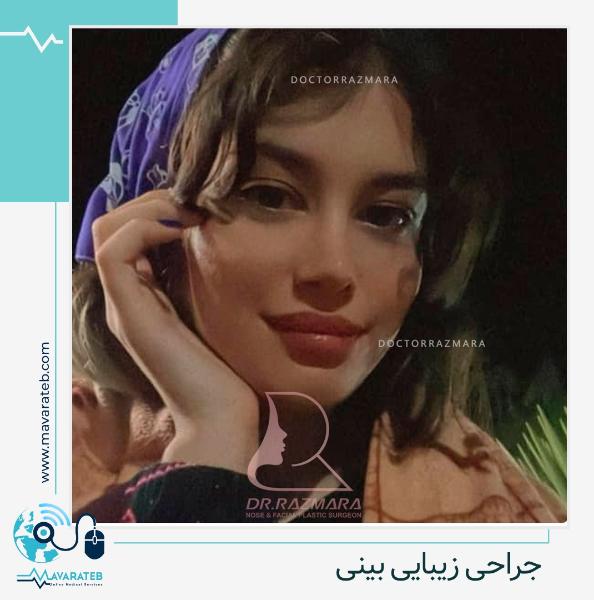 رینوپلاستی چه تفاوتی با عمل بینی دارد؟