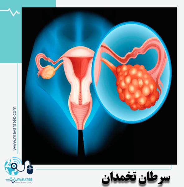 علائم هشدار دهنده ی سرطان تخمدان!