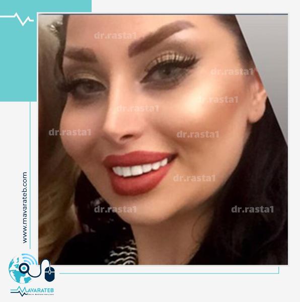 تغییـــرات شگفـت انگیـــز بینــی‼️
