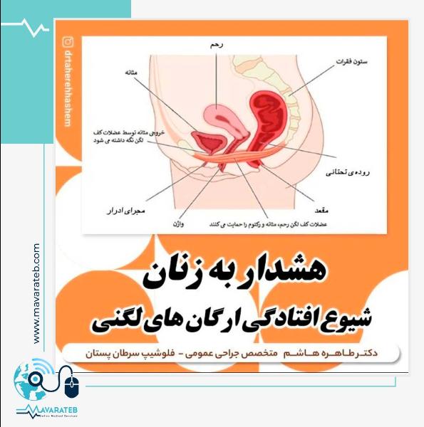 افتادگی ارگان های لگنی
