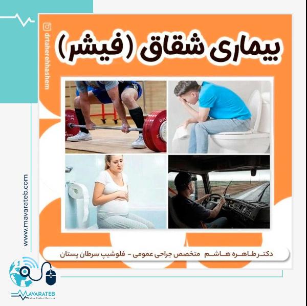 شقاق یا فیشر چیست!