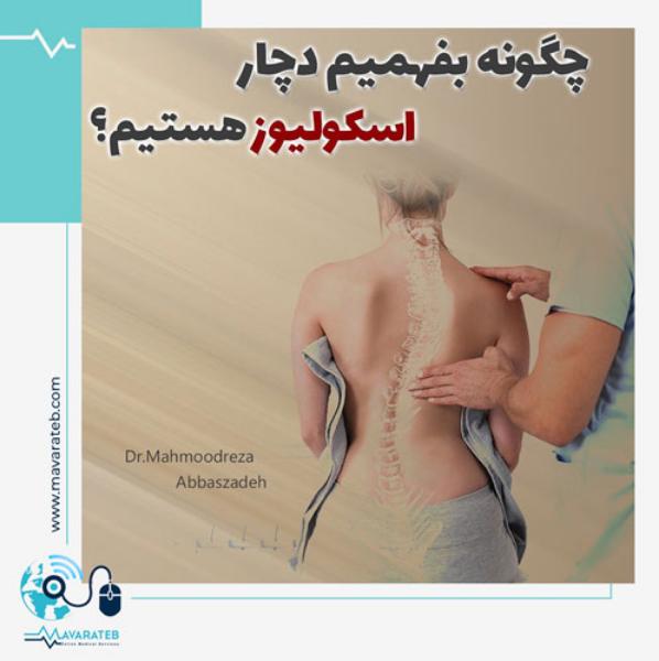 عوارض اسکولیوز