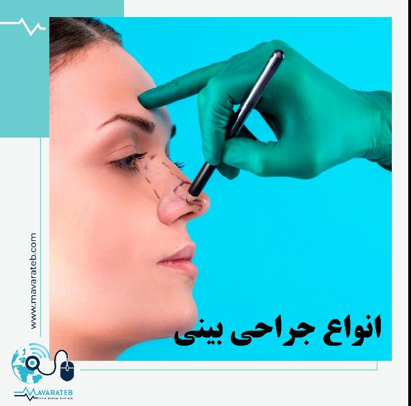 انواع روش های جراحی بینی