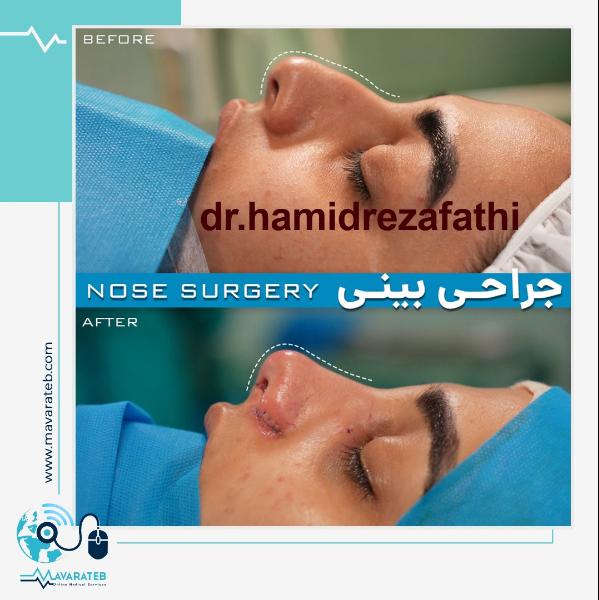 جراحی بینی