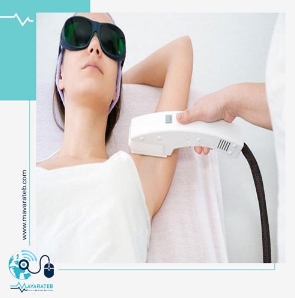 مزایای لیزر موهای زائد