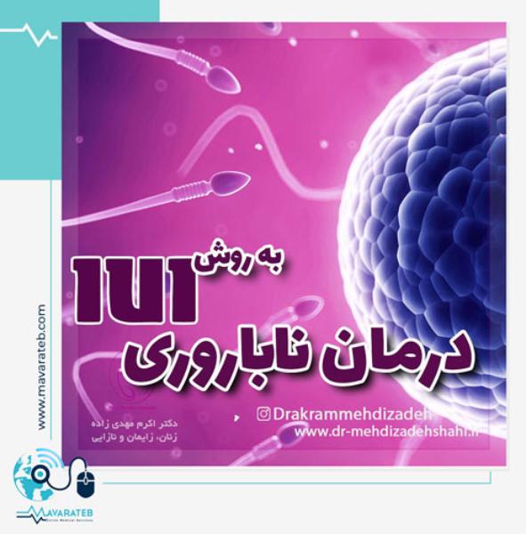 درمان ناباروری به روش IUI