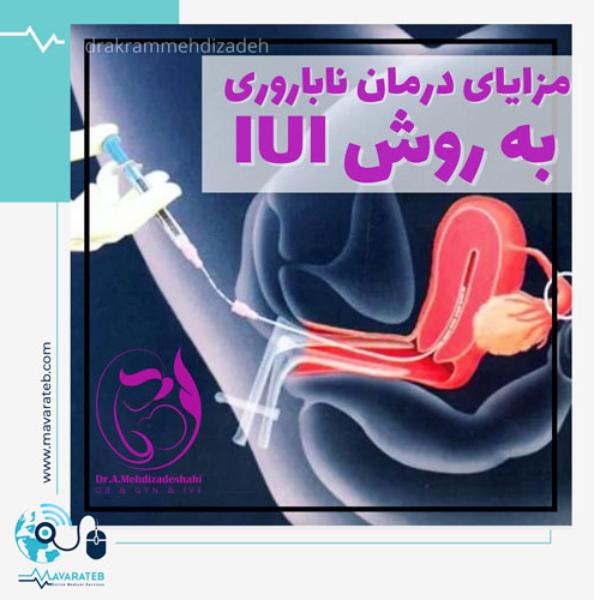 مزایای درمان به روش IUI