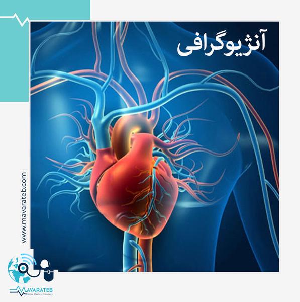 آنژیوگرافی قلب