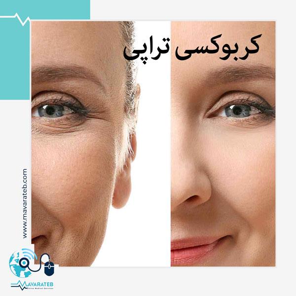 کربوکسی تراپی چیست!!