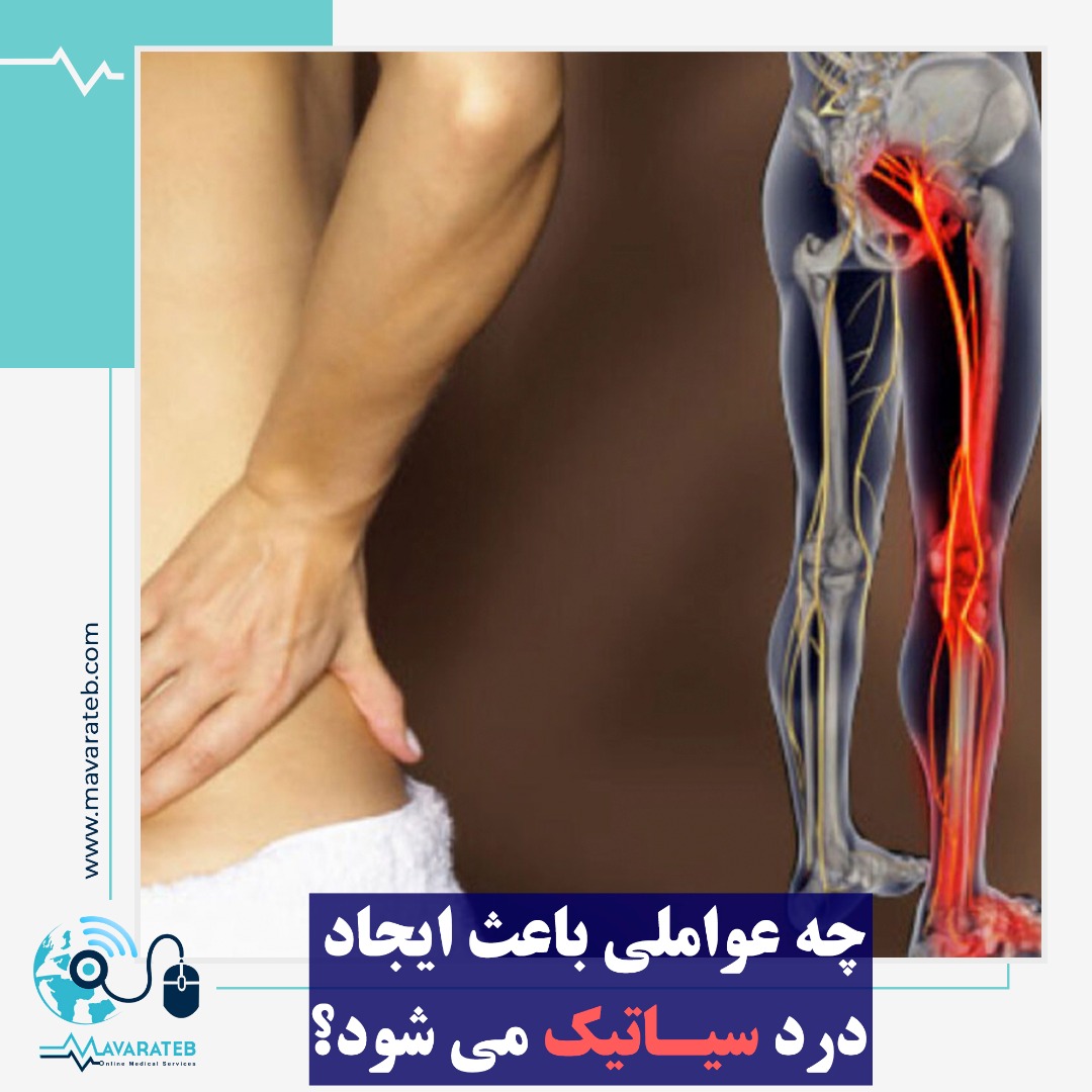 علت اصلی دردهای سیاتیک