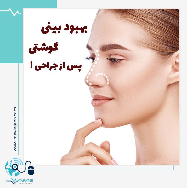 بهبودی بعد از عمل بینی گوشتی سخت تر است؟