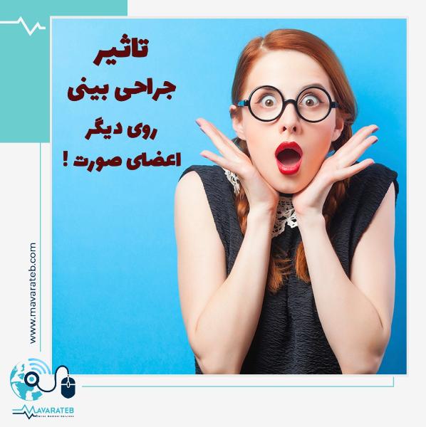 تغییر چهره بعد از عمل بینی