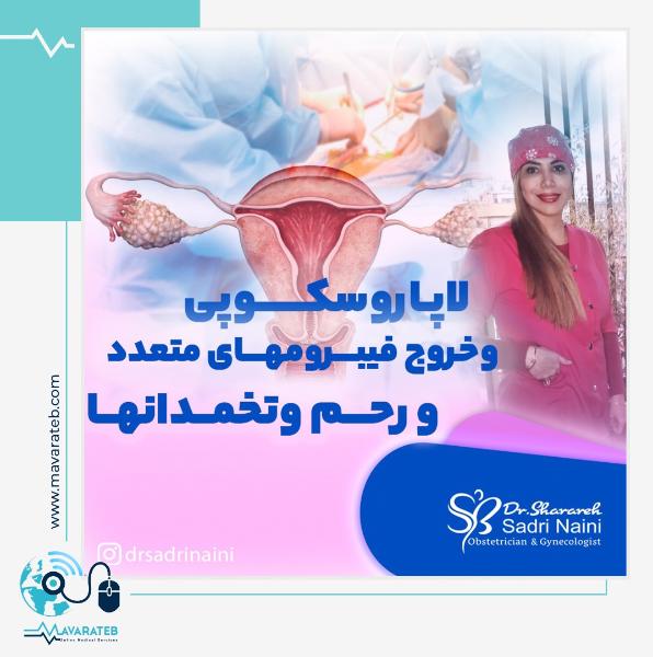 چگونگی جراحی لاپاراسکوپی