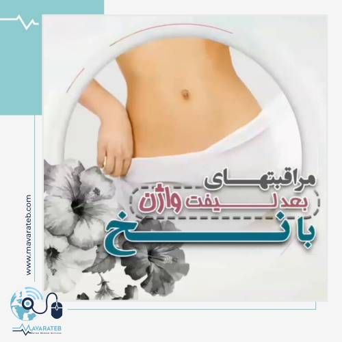 مراقبت های بعد از لیفت واژن با نخ