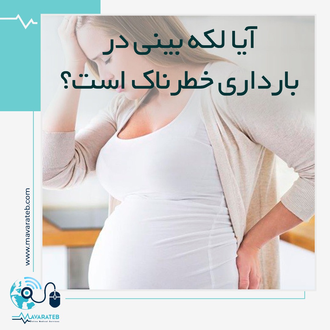 لکه بینی در بارداری
