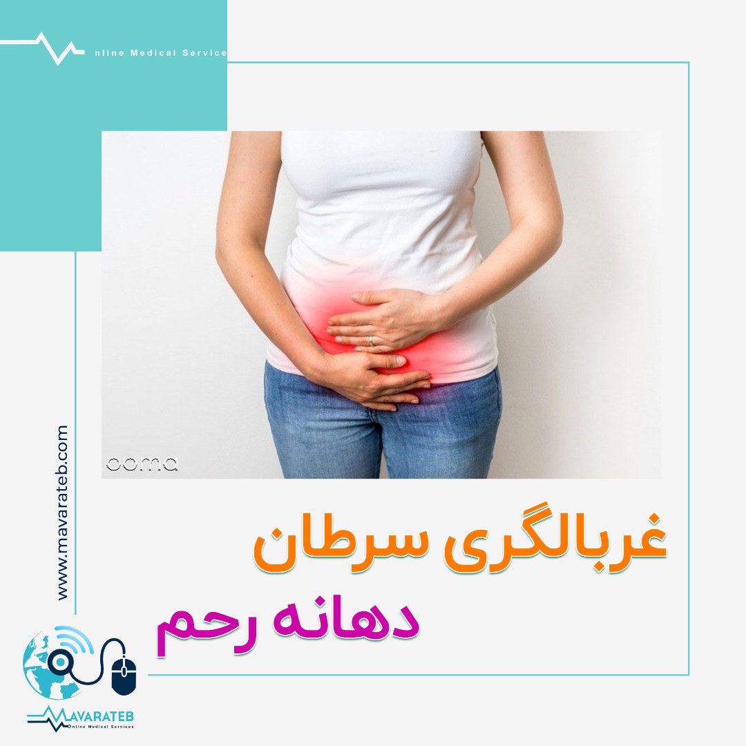 غربالگری سرطان دهانه رحم