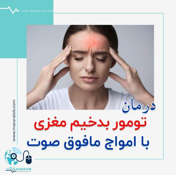 جدیدترین روش درمان تومور مغزی