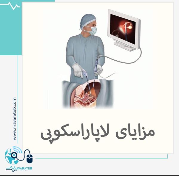 لاغر شدن با جراحی لاپاراسکوپی