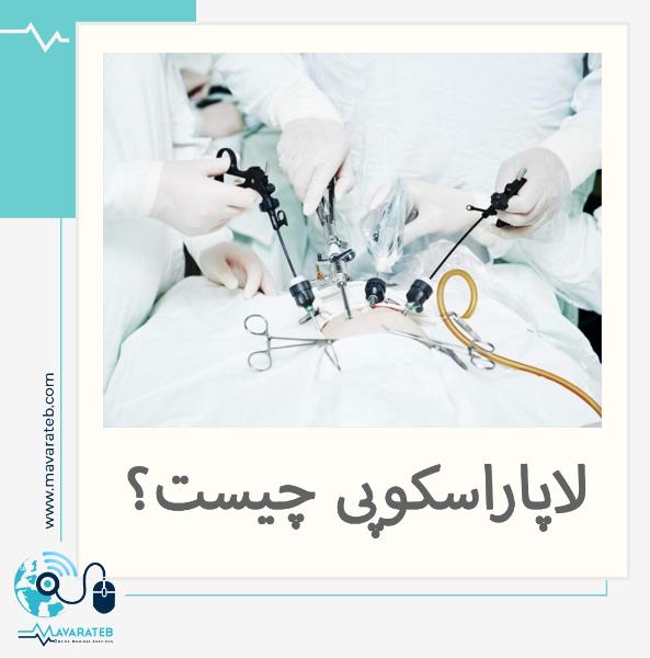 جدیدترین عمل لاغری شکم