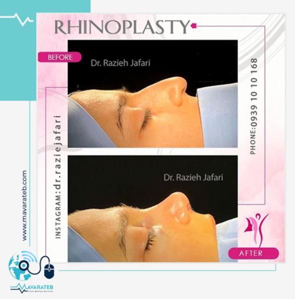 عمل نیمه فانتزی بینی دکتر راضیه جعفری