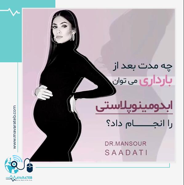 ابدومینوپلاستی