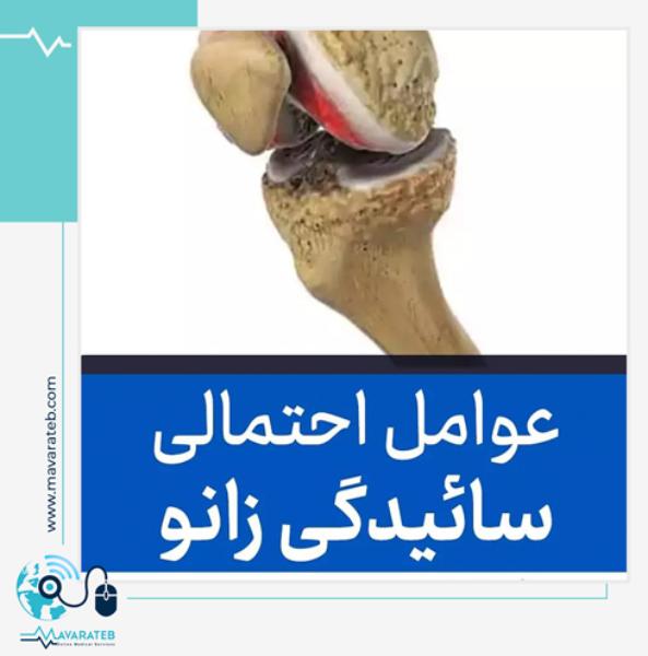 علت سائیدگی زانو را بشناسید