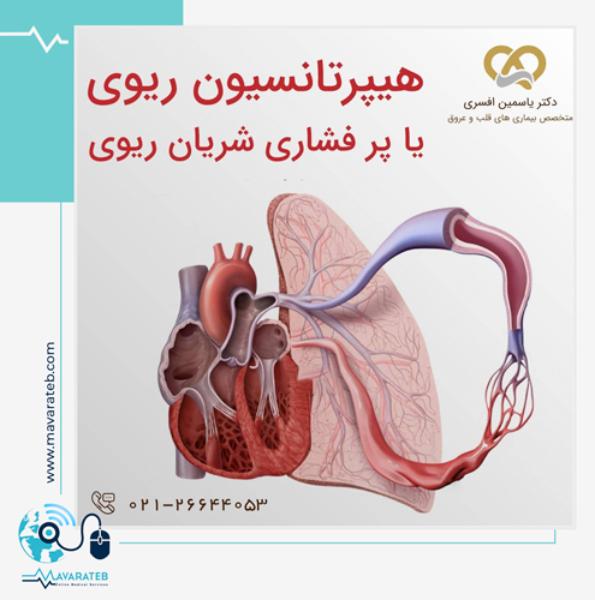 طول عمر بیماران فشار خون ریوی