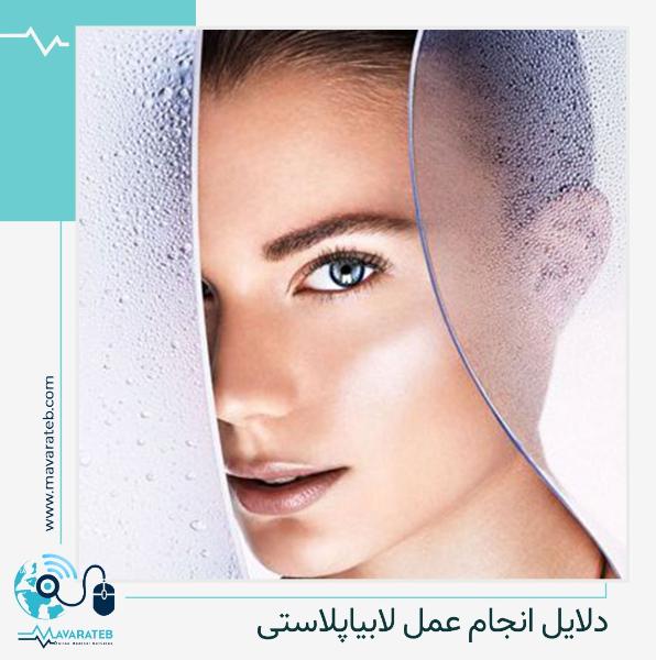 چرا قصد انجام لابیاپلاستی دارید؟!