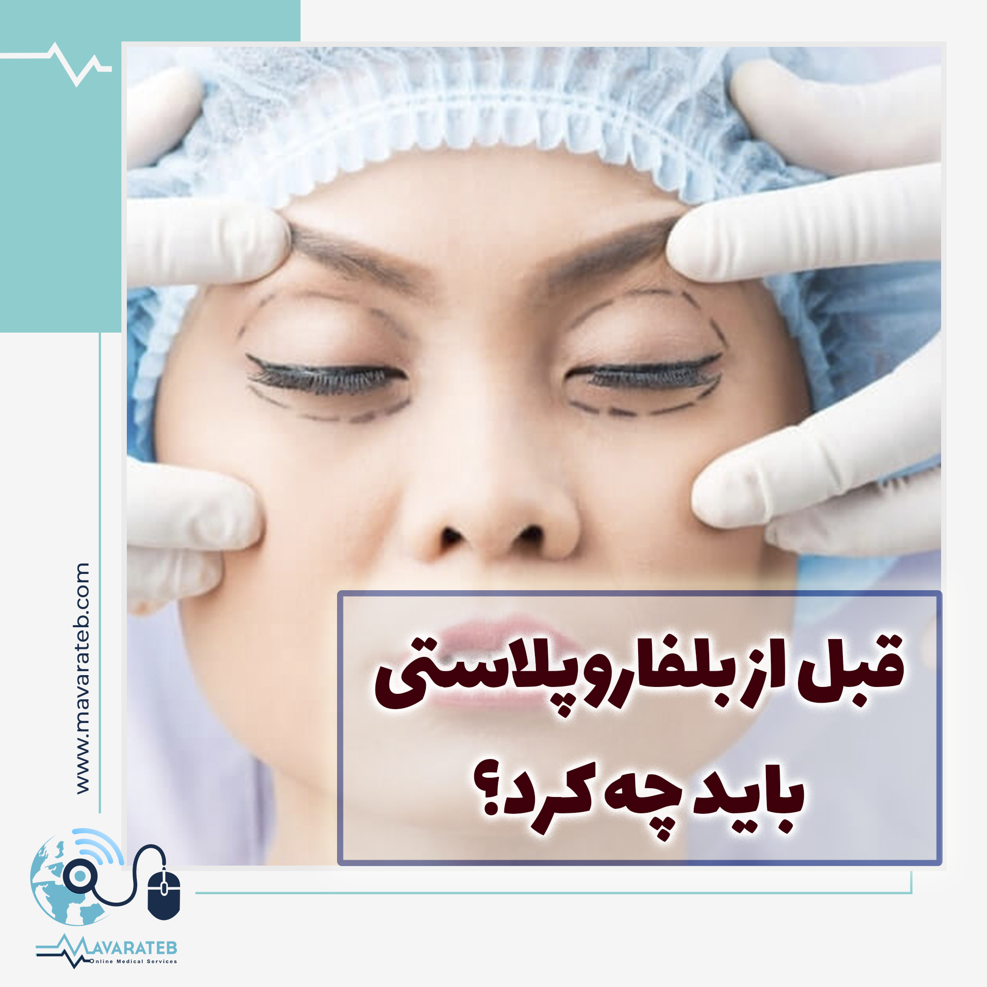 قبل از عمل زیبایی پلک دقت کنید که...