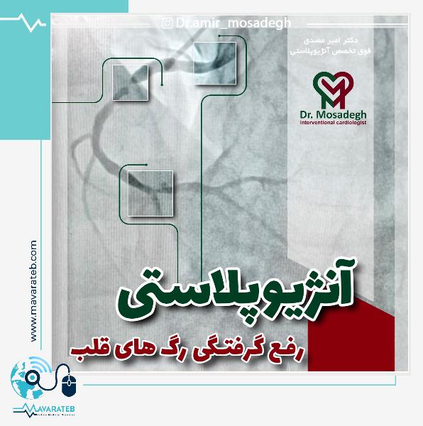 زندگی بعد از آنژیوپلاستی